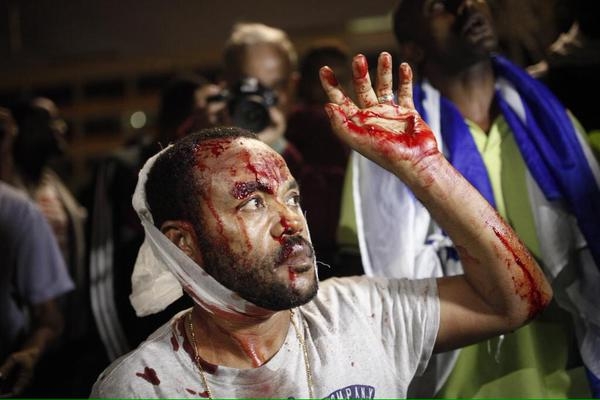 İsrail'de "ırkçı" polis şiddeti 39