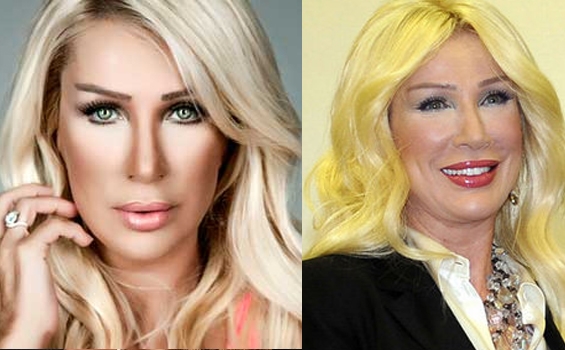 Ünlüleri Photoshop'suz görün! 8