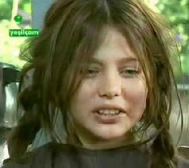 Burçin Abdullah’ın  inanılmaz değişimi 4