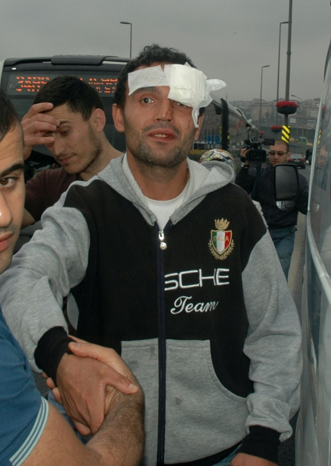 Metrobüste feci kaza: 16 yaralı 4