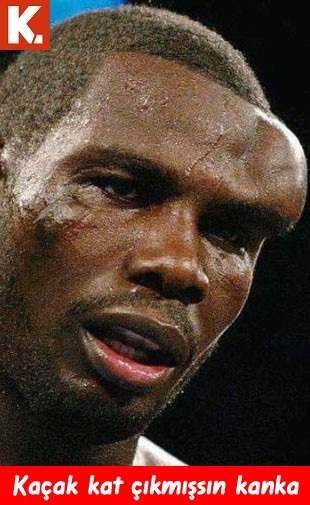 Gülmelik capsler 17