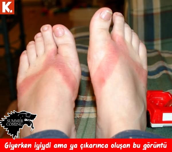 "Summer is coming" capsleri 13