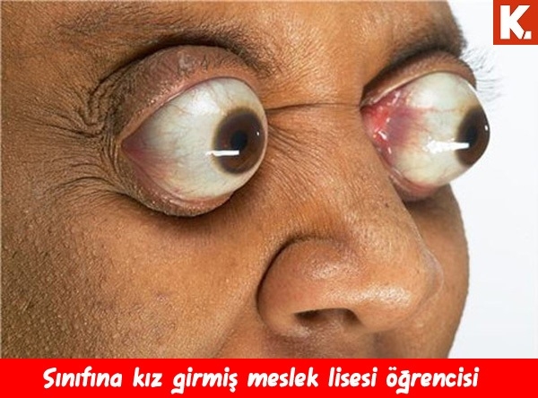 Bu capsler çok farklı 12