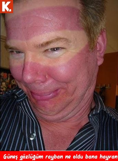 Patronla arası bozuk olanlar için capsler 15