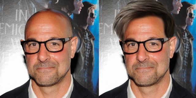 'Bazen kel olmak iyidir' dedirten 10 ünlü 10