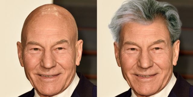 'Bazen kel olmak iyidir' dedirten 10 ünlü 4