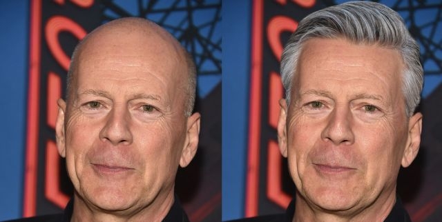 'Bazen kel olmak iyidir' dedirten 10 ünlü 5