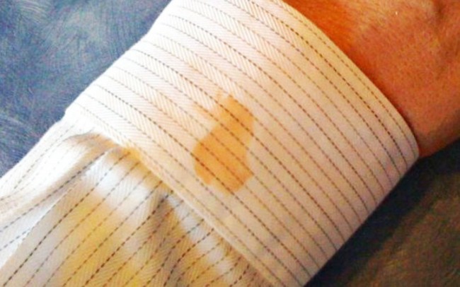 Karbonatın 10 faydası 6