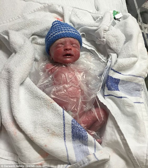 30 haftalık bebeği poşete koydular 1