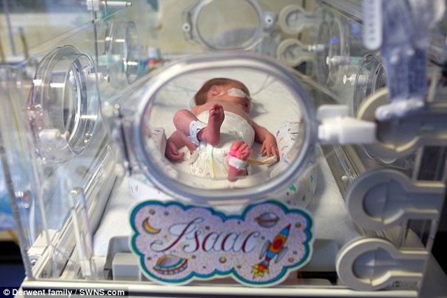 30 haftalık bebeği poşete koydular 3