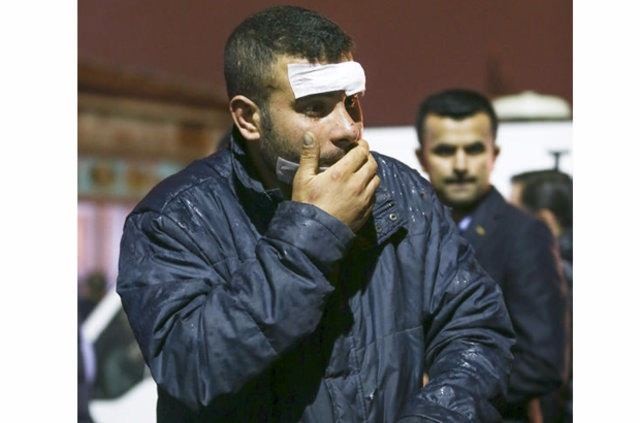 Ankara'daki patlamada ölenlerin yürek burkan hikayeleri 17