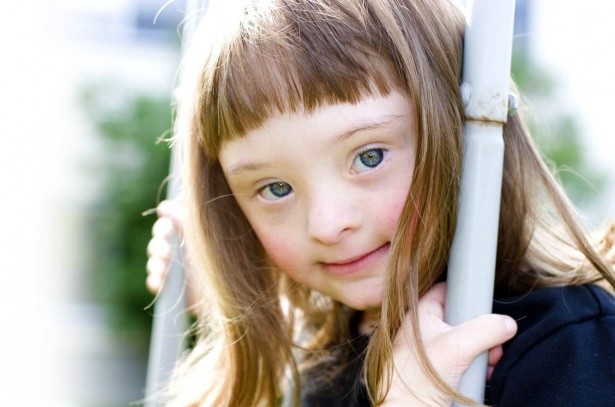 21 Mart Down Sendromu Günü 14