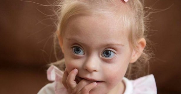 21 Mart Down Sendromu Günü 16