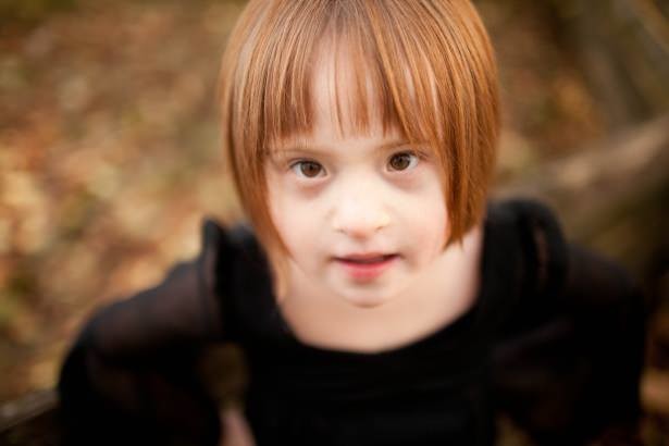 21 Mart Down Sendromu Günü 17