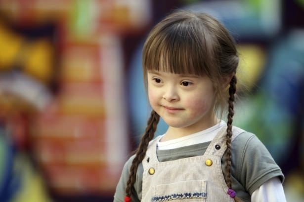 21 Mart Down Sendromu Günü 20