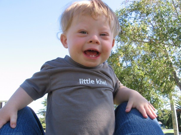 21 Mart Down Sendromu Günü 22