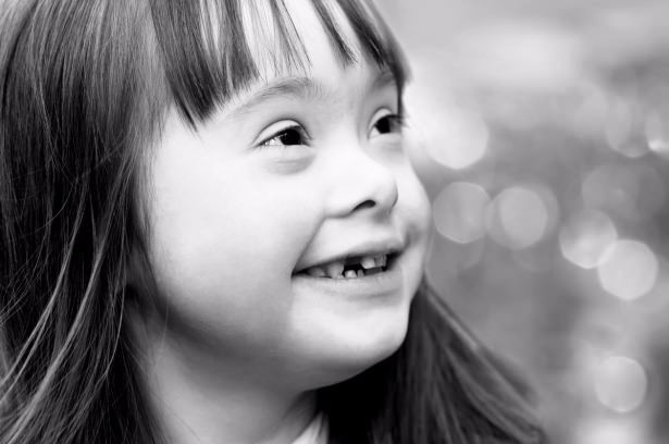 21 Mart Down Sendromu Günü 29