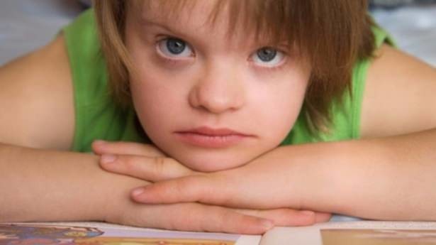 21 Mart Down Sendromu Günü 33