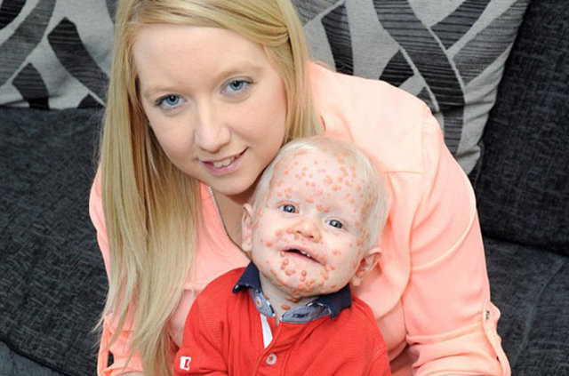 Bu bebeğe dokunmaya korkuyorlar 1