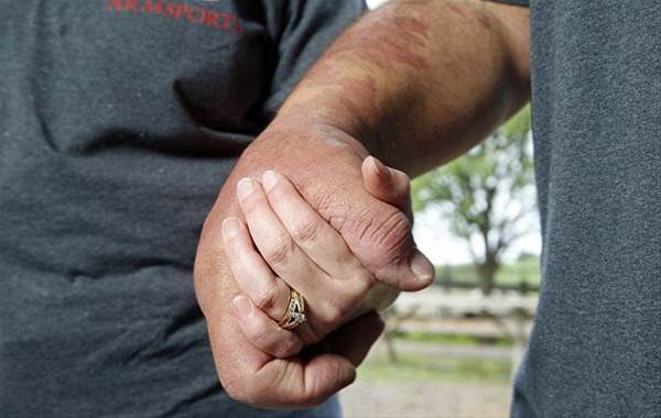 Ona kemikkıran diyorlar 6