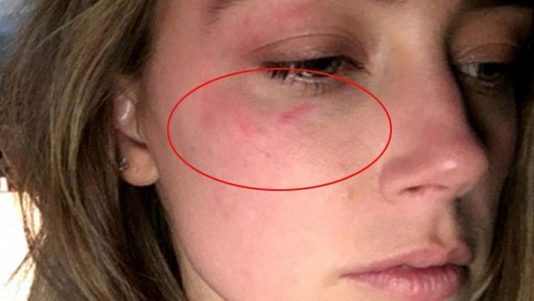 Amber Heard'den Johnny Depp hakkında şok iddia 2