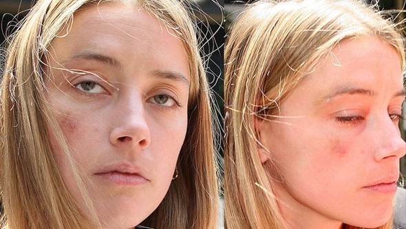 Amber Heard'den Johnny Depp hakkında şok iddia 3