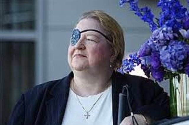 Ameliyat ortasında dehşete uyanmak 13