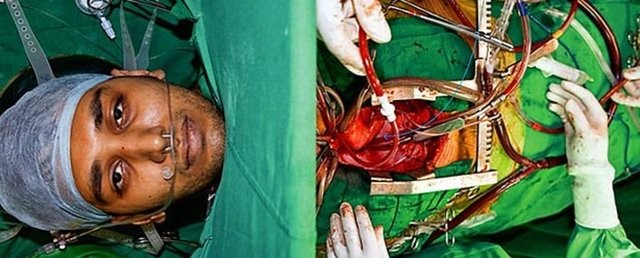 Ameliyat ortasında dehşete uyanmak 25