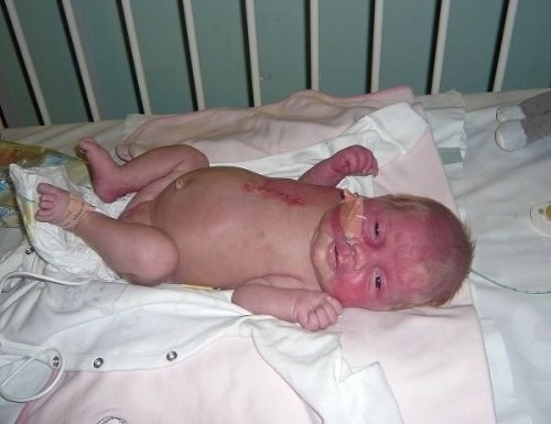 Dünyanın en garip hastalıkları 7