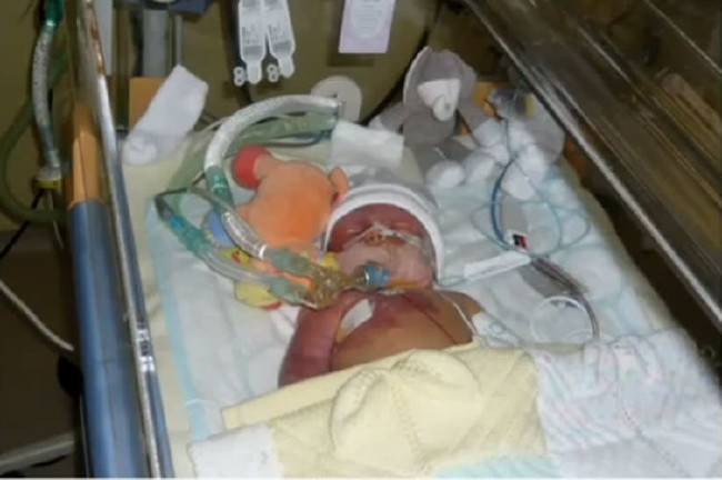 Dünyanın en garip hastalıkları 8