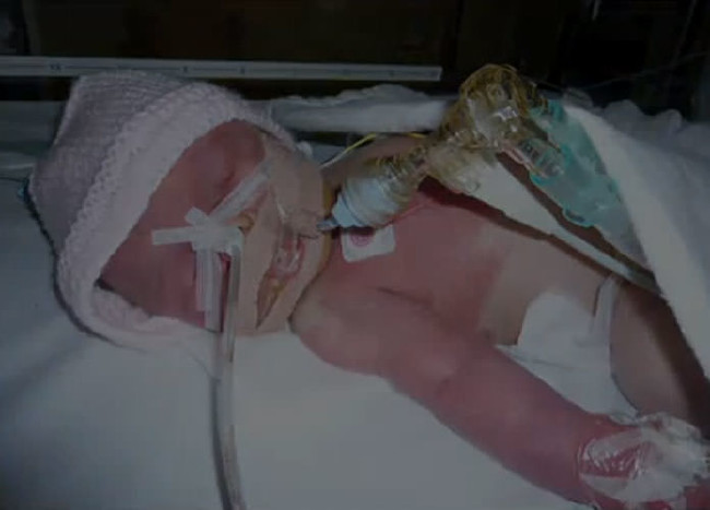 Dünyanın en garip hastalıkları 9