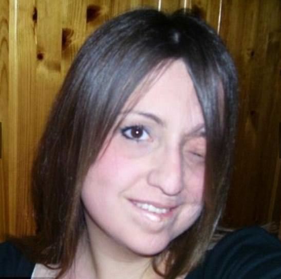 Dünyanın en garip hastalıkları 10