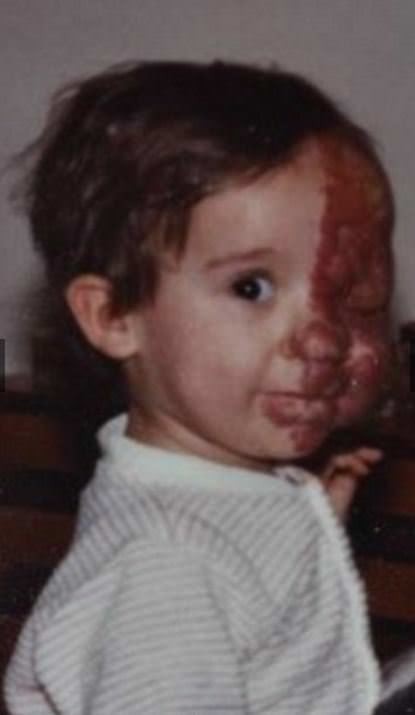 Dünyanın en garip hastalıkları 11