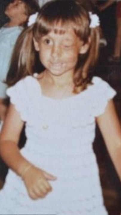 Dünyanın en garip hastalıkları 12