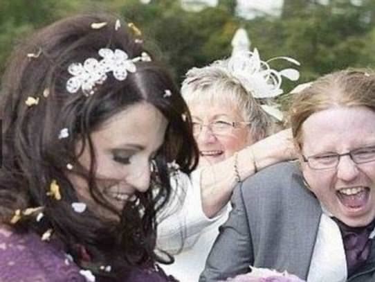 Dünyanın en garip hastalıkları 17