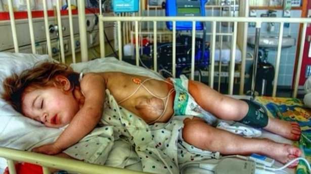 Dünyanın en garip hastalıkları 18