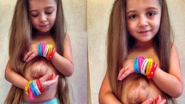 Dünyanın en garip hastalıkları 19