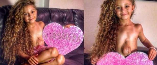 Dünyanın en garip hastalıkları 20