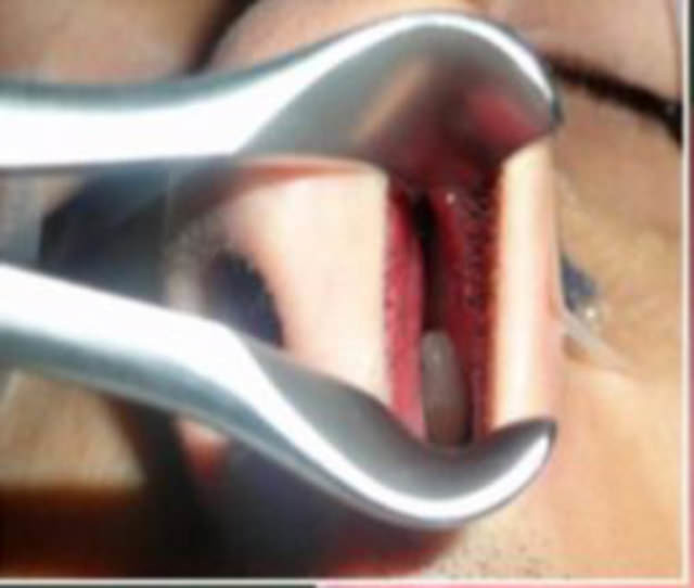 Dünyanın en garip hastalıkları 21