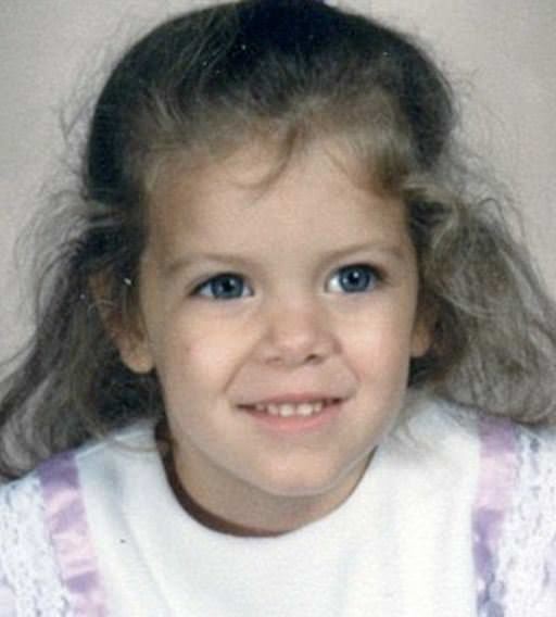 Dünyanın en garip hastalıkları 26