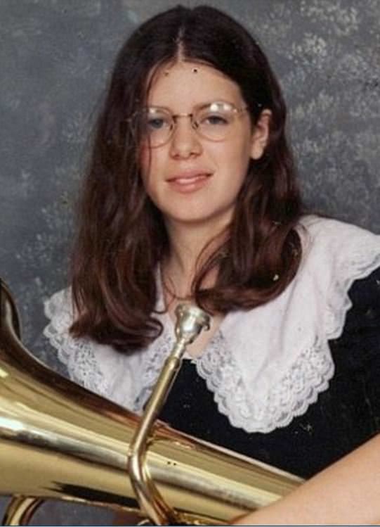 Dünyanın en garip hastalıkları 27