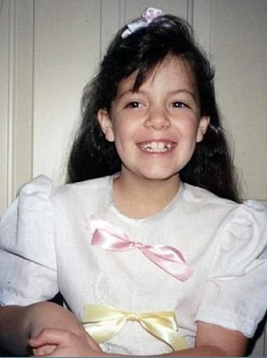 Dünyanın en garip hastalıkları 28