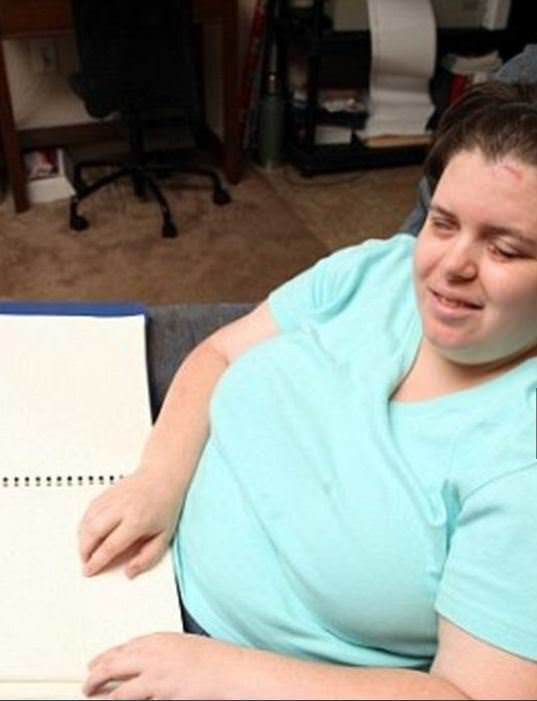 Dünyanın en garip hastalıkları 29