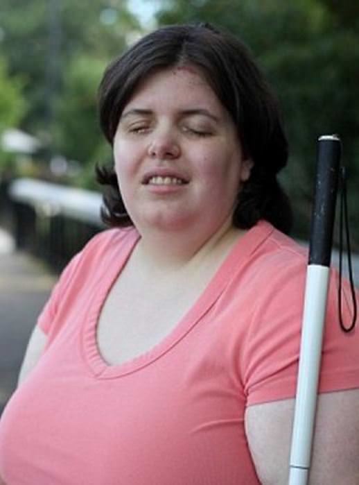 Dünyanın en garip hastalıkları 30