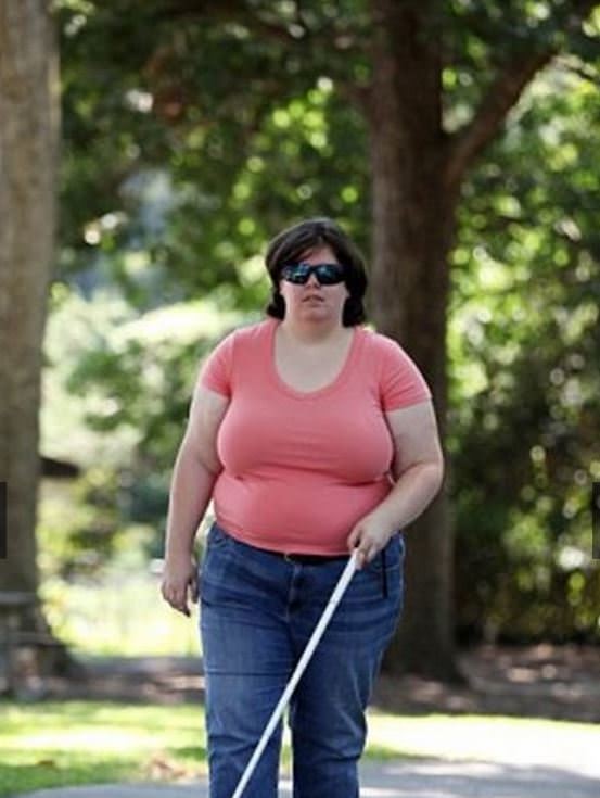 Dünyanın en garip hastalıkları 31