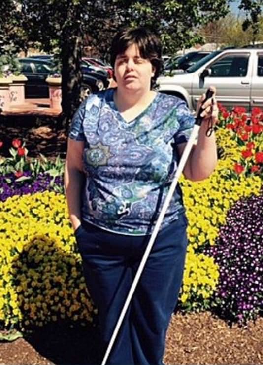 Dünyanın en garip hastalıkları 32