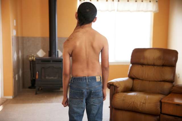 Dünyanın en garip hastalıkları 34