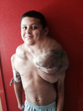 Dünyanın en garip hastalıkları 36