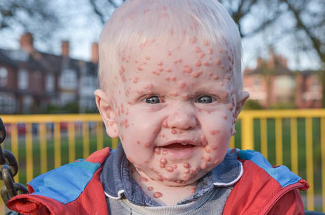 Dünyanın en garip hastalıkları 1