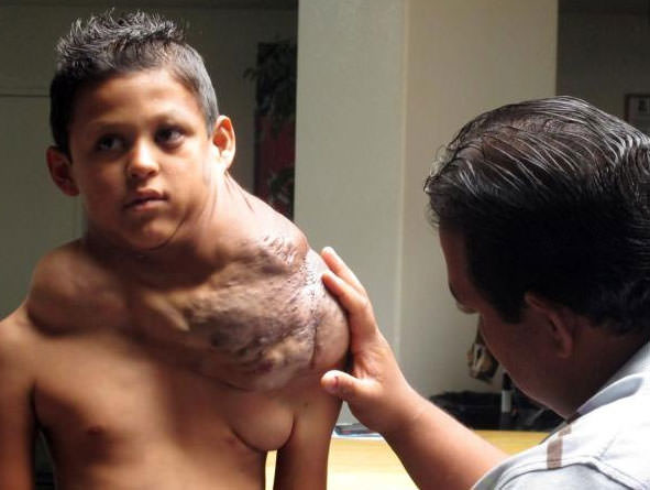 Dünyanın en garip hastalıkları 37